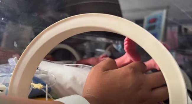 Nacieron trigemelas en Chubut: un milagro que ocurre una vez cada millones de embarazos