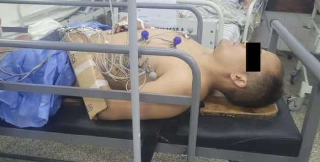 Intentó robarle el auto a una mujer policía y la pareja de la oficial le fracturó los dos brazos