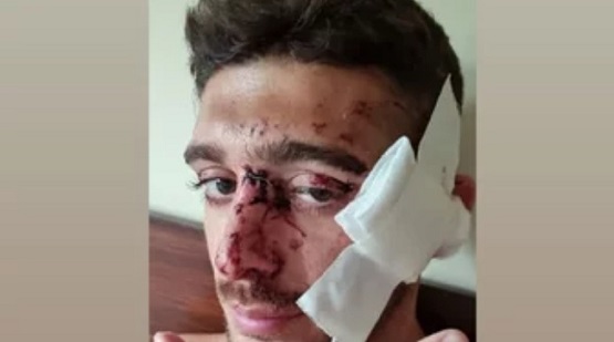 Buscan al automovilista que chocó a un joven a la salida de un boliche y huyó