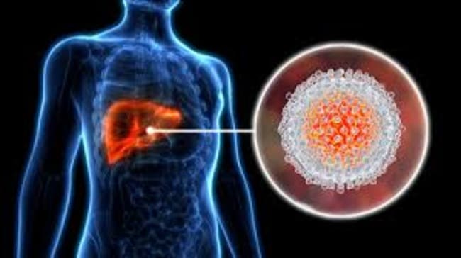 Leia Hepatitis C, lanzan una campaña que busca pacientes para curarlos 