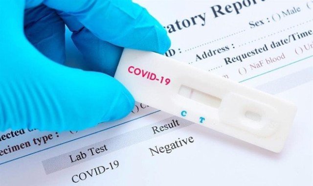 Autotest de Covid-19: La próxima semana todas las farmacias del país tendrán a la venta