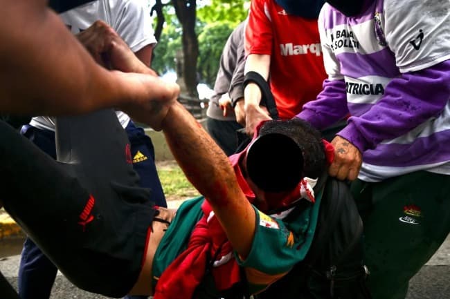 Leia Parte médico de Pablo Grillo, el fotógrafo atacado por policías en la marcha de los jubilados