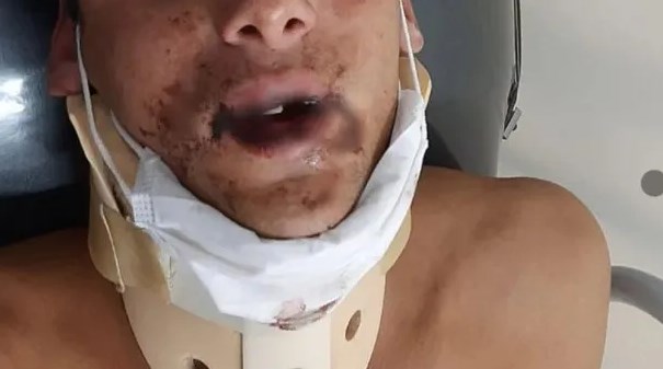 Salvaje ataque de un rugbier en un bar: «Lo siguió golpeando estando desmayado»