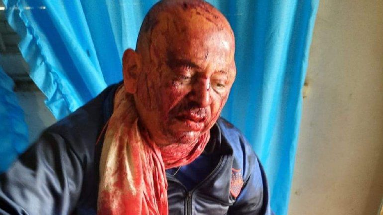 Brutal golpiza a un jubilado discapacitado para robarle 9 mil pesos