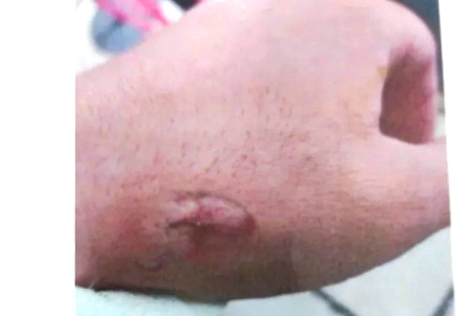 Insólito: mordió a un policía porque no le permitió entrar a un boliche cerrado